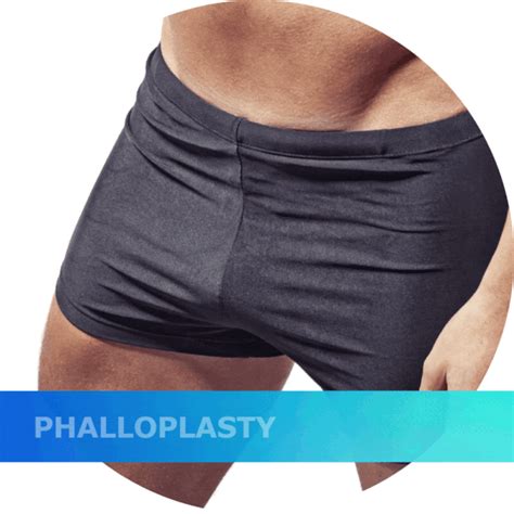 faloplastia|Phalloplasty: Purpose, Recovery, and More